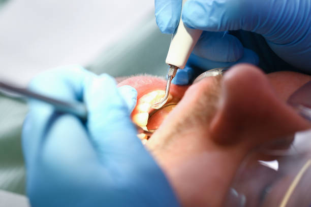 Best Pediatric Emergency Dentist in Benson, NC
