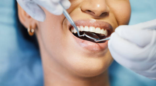 Best Emergency Tooth Extraction in Benson, NC