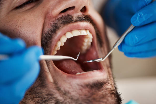 Best Urgent Dental Care in Benson, NC